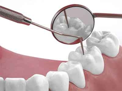 Improving Dentistry: The Benefits of Same-Day Dentistry