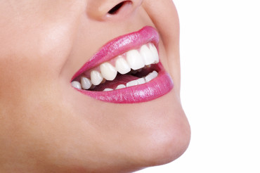 Refine Your Smile With Dental Implants