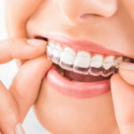 Invisalign®: The Most Discreet Way to Straighten Teeth
