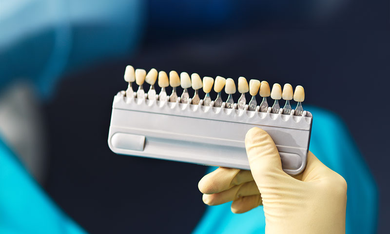 Unraveling the Connection: How Root Canals and Dental Crowns Work Together